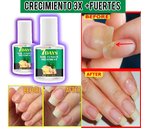 Base Endurecedor de Uñas 4K POTENTE - Compre 1 y Lleva 2 GRATIS